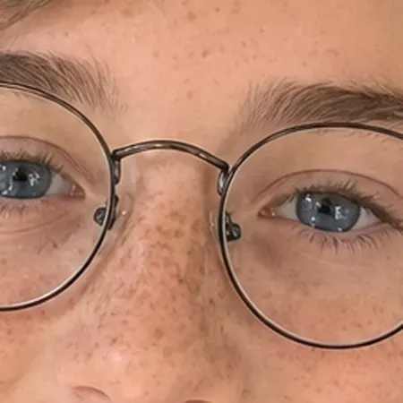 Zoomed in on the eyes: still sharp, you can see eyelashes and freckles